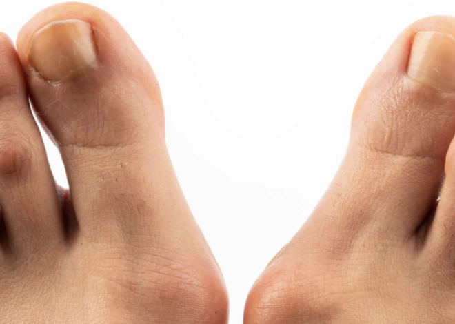 Teknik Stimulasi Mandiri untuk Mobilitas Tanpa Batas